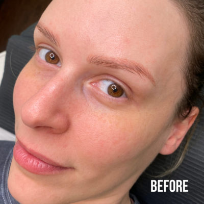 Lindsay Microblading Correction Before Kayana Beauty Web